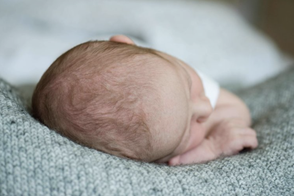 What’s Normal for a Baby’s Soft Spot?