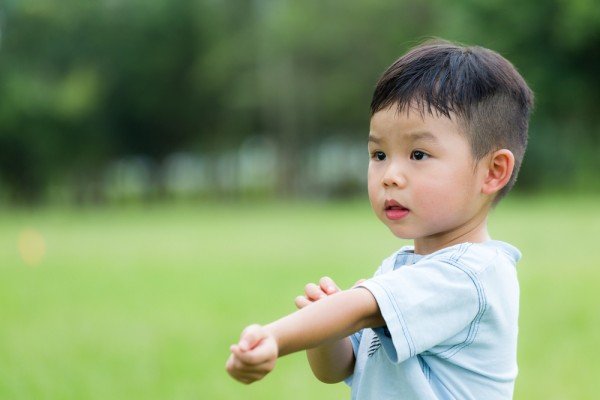 How to treat a wasp or bee sting in a baby