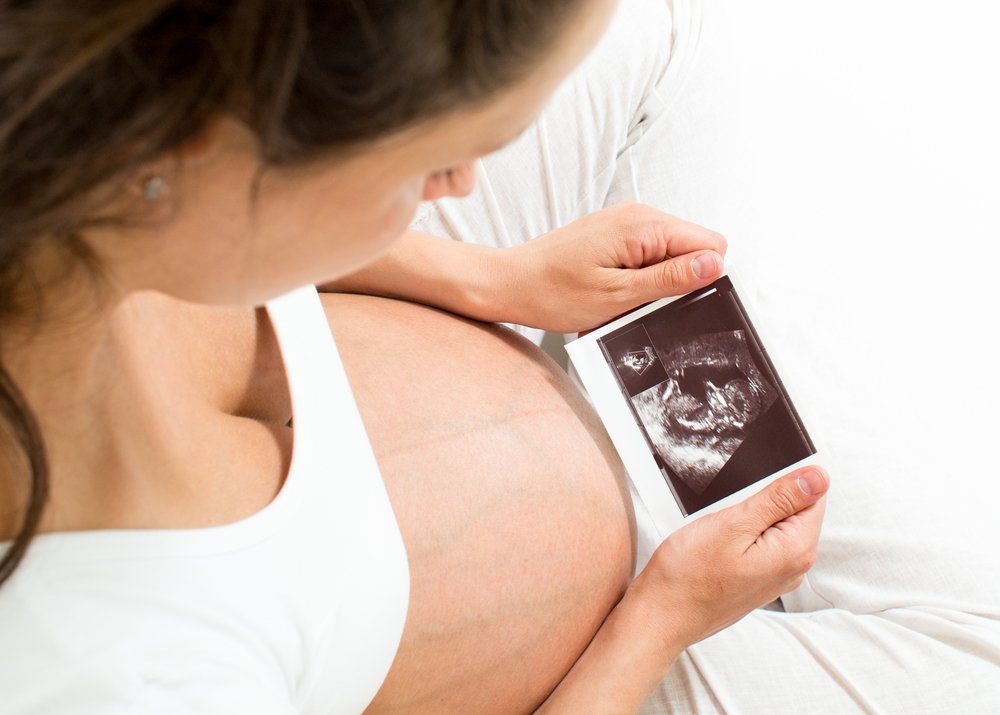 pregnant woman looking at an ultrasound