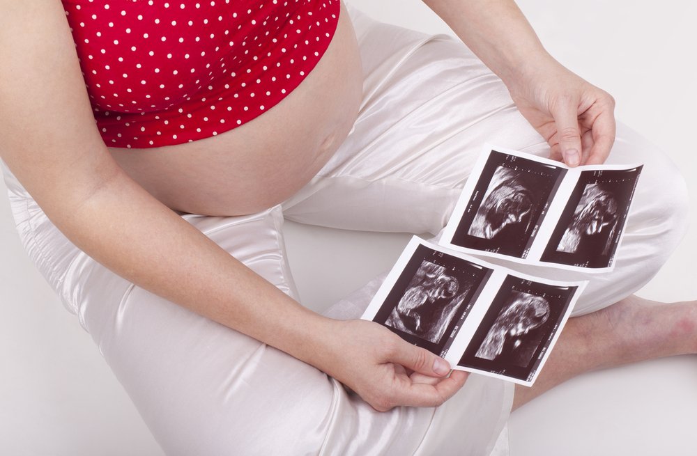 pregnant woman holding two ultrasounds